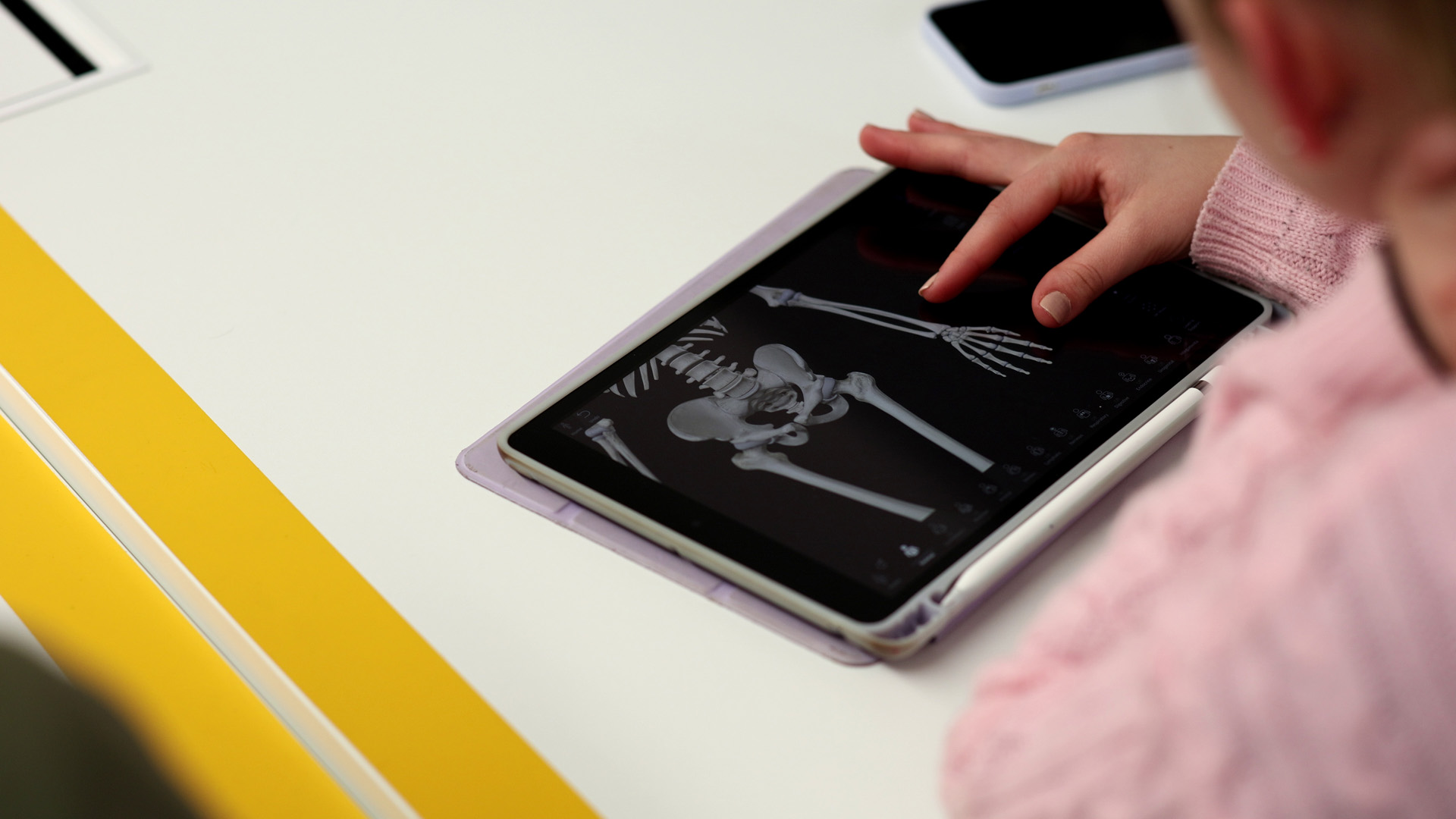 studentessa guarda immagine di Radiodiagnostica